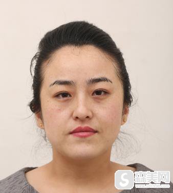 南昌水光补水要去同济整形妙手？附术后恢复记录