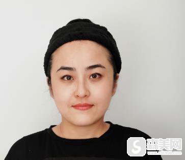 南昌水光补水要去同济整形妙手？附术后恢复记录