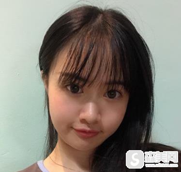 哪些人不适合打注射瘦脸？北京八大处恢复日记分享