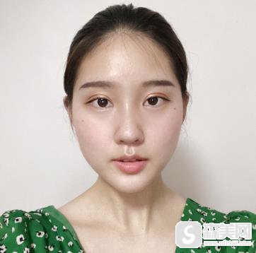 哪个医院有欧洲之星?上海九院案例果好不好?