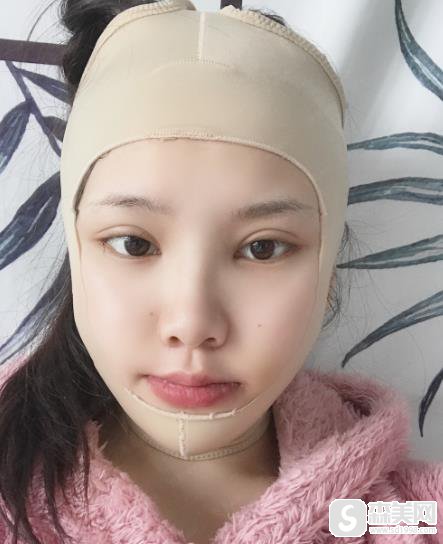 浙一医院磨骨多少钱大概？附90天恢复记录