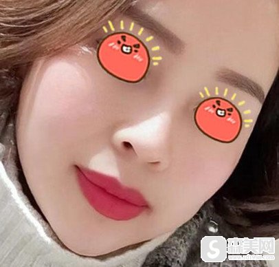 金华瑞丽整形美容医院怎么样?隆鼻技术好不好?案例分享