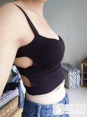 深圳希思整形医院李俊医生做自体脂肪隆胸怎么样?附果图浏览