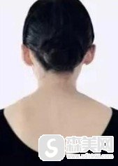 北京八大处医院打注射瘦肩!医院信息,附案例果图