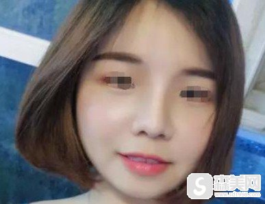 福州比华利整形医院林秋荣医生怎么样?附案例术后对比果图