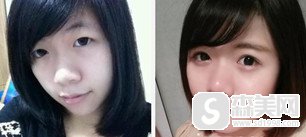 杭州同欣整形美容医院怎么样?有着怎样的技术和经营理念?