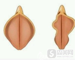 黑龙江阳光女子医院怎么样?私密整形怎么样?案例分享