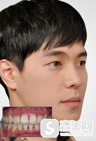 中国医科大学口腔医院卢利医生牙齿矫正术后果对比！医院信息