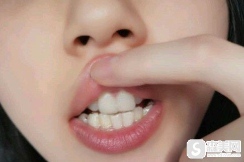 河南省郑州大学口腔医院刘一鸣医生很有！医院信息,附矫正牙齿果图对比