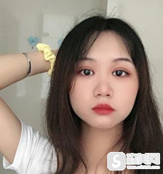 江苏省中医院整形科眼部果?附真实果图浏览