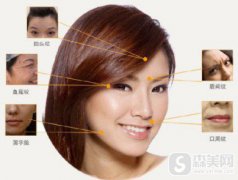 表情纹应该怎么样才可以消除掉？怎么形成的,如何管理表情纹