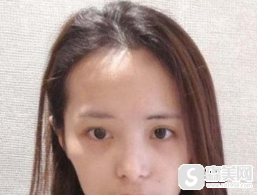 八大处面部填充较好的医生,附医生信息及术后果图