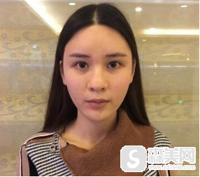 浙二医院有欧洲之星4D项目么？医生信息附术后果图浏览