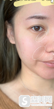 武汉协和医院有欧洲之星吗？医生信息,欧洲之星果对比图浏览