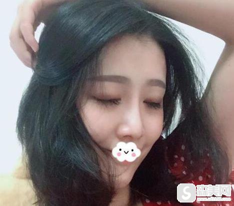 重庆爱思特整形美容医院的口碑怎么样？医生信息,附隆鼻术后果图