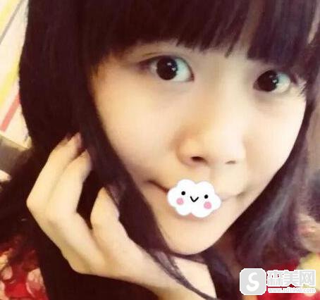 重庆爱思特整形美容医院的口碑怎么样？医生信息,附隆鼻术后果图