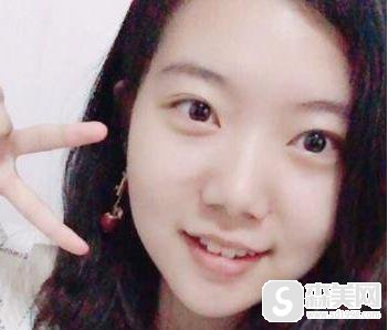 重庆华美整形美容医院口碑怎么样？医生信息, 附磨骨手术术后果图浏览