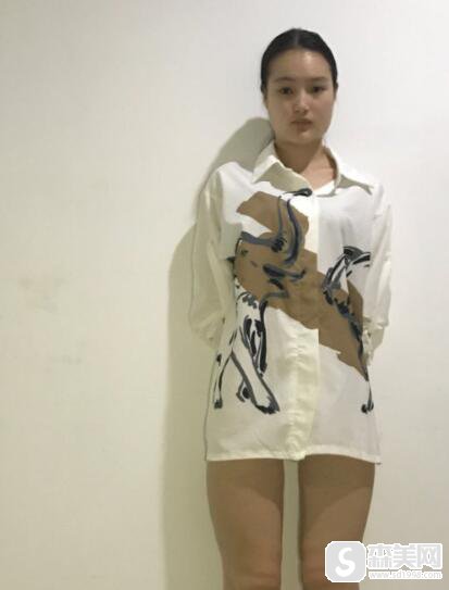 上海时光医院做吸脂手术果怎么样?医院信息,附术后果图浏览