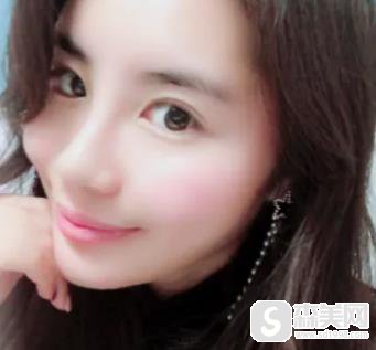 华西玻尿酸填充价格贵不贵?整形科恢复图浏览