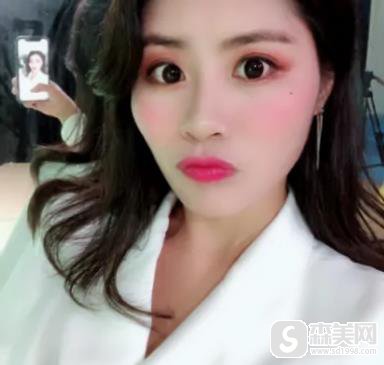 华西玻尿酸填充价格贵不贵?整形科恢复图浏览