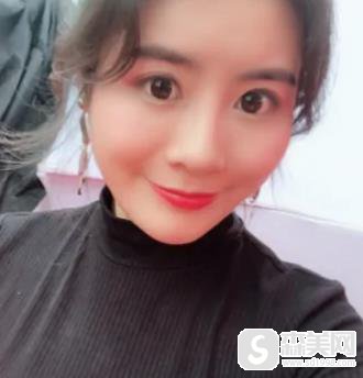 华西玻尿酸填充价格贵不贵?整形科恢复图浏览