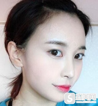 成都碧莲盛植发2021价格表一览,附种植发际线案例分享