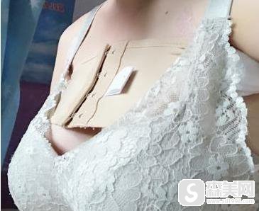 上海薇琳医疗美容医院做隆胸果怎么样呢?医生信息,术后对比图浏览