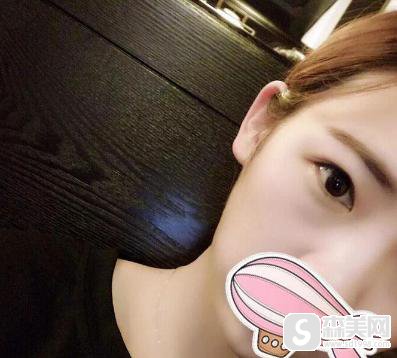 上海首尔丽格整形医院双眼皮案例分享！医生信息,附术后果对比图