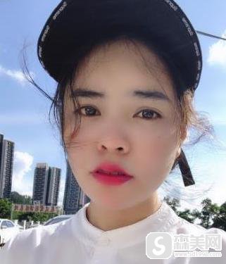 上海华山整形医院穆雄铮医生做磨骨怎么样?医生信息,附术后果图对比