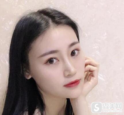 潍坊医学院整形外科医院做隆鼻果好不好？医生信息,分享术后对比图