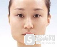 上海首尔丽格磨骨价格多少呢?医生信息,附磨骨术后果图对比