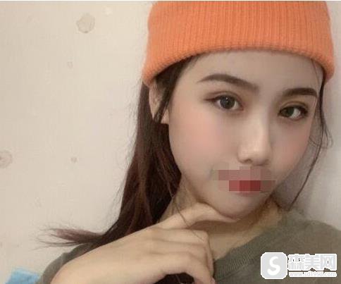 广州现代医院正规吗?医生资质如何/案例展示