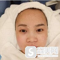 在新疆整形医院找苏炳云做的水光补水真的能够改善皮肤的问题吗?