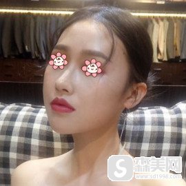 新疆梁青松整形的技术是怎样的风格?隆鼻以后真的能使面部变得立体吗?