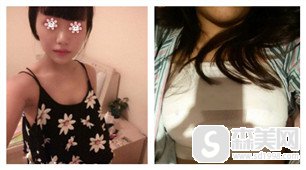 新疆黎美整形医院怎么样?隆胸的技术是不是特别棒?