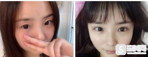 武汉铁路医院整形科情况如何-医生情况-案例展示