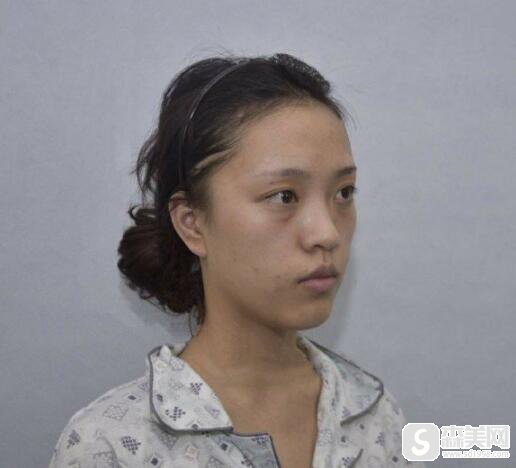 上海愉悦美联臣医院靠谱吗?医生信息,附案例果图浏览