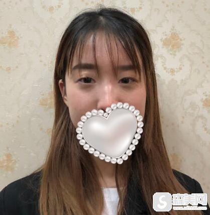 南京医科大学友谊整形外科医院是三甲医院吗?医生信息,附双眼皮术后果图