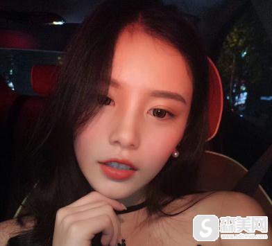 陈兵医生瑞兰隆鼻多少钱?术后果分享