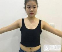 成都八大处专业丰胸要多少钱？附真实案例对比