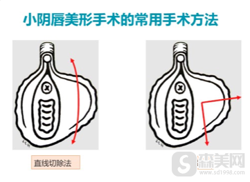 童晋文医生的私密技术好吗,找他做放心吗,附恢复日记分享