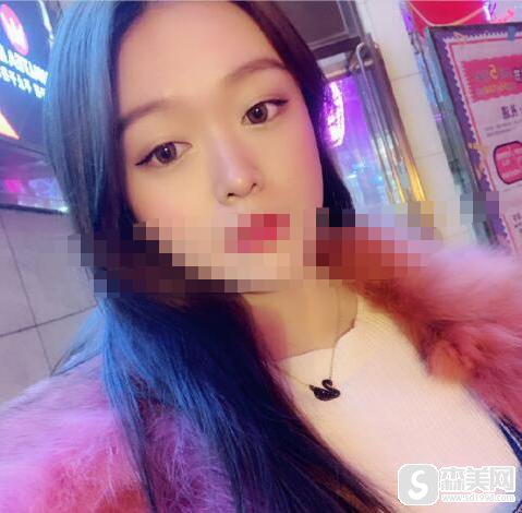 肿泡眼可以抽脂去除吗?真实祛除眼袋案例附术后果图