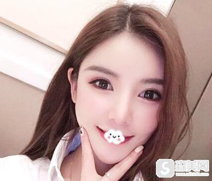 下颌角整形，拯救我的“嫩牛五方脸”   真实案例分享