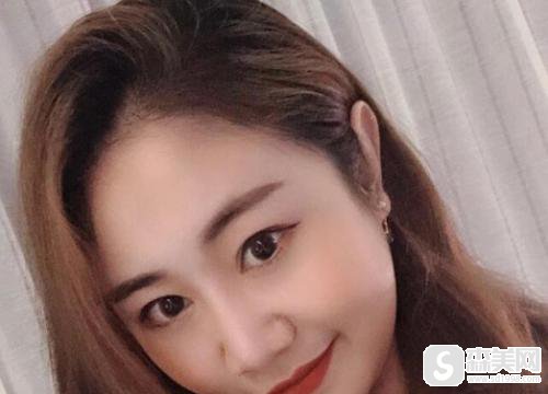 美联臣整形医院激光祛痘怎么样？专家介绍和案例分享