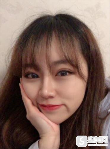 汕头曙光医疗美容医院双眼皮手术怎么样？医生信息,附案例分享浏览