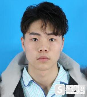 男士隆鼻!术后果对比图,真实案例让大家浏览