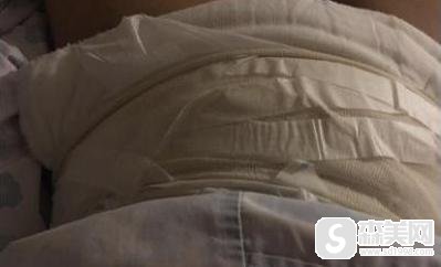 震动吸脂实战案例分享,手术全过程分享附果图