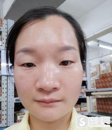 像素激光果好不好