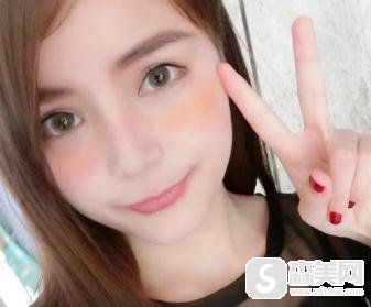 杭州格莱美微笑唇果如何？附真实案例对比