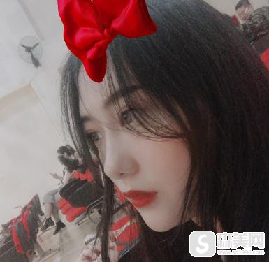 瑞兰玻尿酸隆鼻价格?温州和平医院案例分享